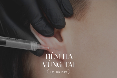 Tiêm HA vùng tai